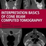 Interpretation Basics of Cone Beam Computed Tomography (Color)