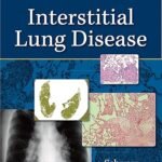 Interstitial Lung Disease Volume 1-2 (Color)