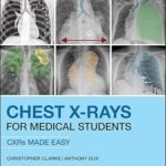 Chest X-Rays for Medical Students. CXRs made easy (Color)