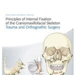 Principles of Internal Fixation of the Craniomaxillofacial Skeleton: Trauma and Othognathic Surgery (Color)