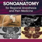 Atlas of Sonoanatomy for Regional Anesthesia and Pain Medicine (Color)