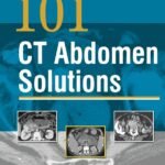 101 CT Abdomen Solutions (Color)