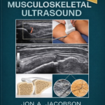Fundamentals of Musculoskeletal Ultrasound (Color)