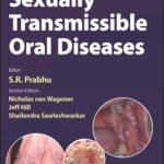 Sexually Transmissible Oral Diseases (Color)