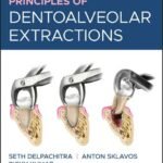 Principles of Dentoalveolar Extractions (Color)