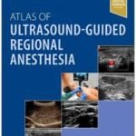 Atlas of Ultrasound-Guided Regional Anesthesia (Color)