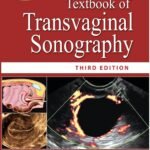 Donald School Textbook of Transvaginal Sonography (Color)