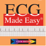 ECG Made Easy