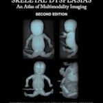 Fetal and Perinatal Skeletal Dysplasias (Color)