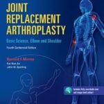 Joint Replacement Arthroplasty: Basic Science (Color)