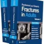 Rockwood and Green's Fractures in Adults Volume 1-6 (Color)