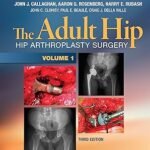 The Adult Hip: Hip Arthroplasty Surgery Volume 1-4 (Color)
