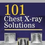 101 Chest X-ray Solutions (Color)
