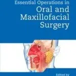 Bailey & Love's Essential Operations in Oral & Maxillofacial Surgery (Color)