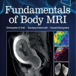 Fundamentals of Body MRI (Color)
