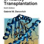 Handbook of Kidney Transplantation (Color)