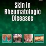 Skin In Rheumatologic Diseases (Color)