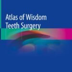Atlas of Wisdom Teeth Surgery (Color)