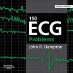 150 ECG Problems (Color)