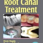 Step by Step Root Canal Treatment (Color)