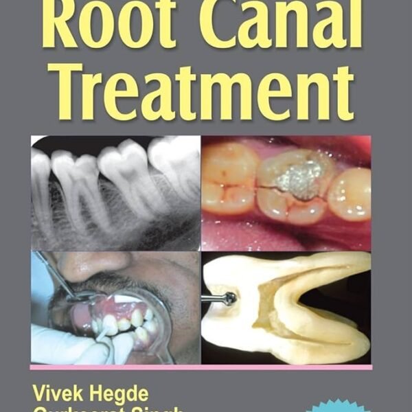 Step by Step Root Canal Treatment (Color)
