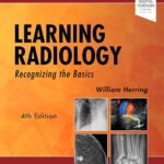 Learning Radiology Recognizing the Basics (Color)