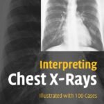 Interpreting Chest X-Rays: Illustrated with 100 Cases (Color)