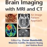 Brain Imaging with MRI and CT (Color)