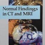 Normal Findings in CT and MRI (Color)