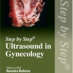 Step by Step Ultrasound in Gynecology (Color)