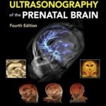 Timor's Ultrasonography of the Prenatal Brain (Color)