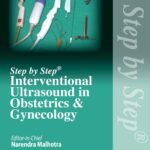 Step by Step Interventional Ultrasound in Obstetrics and Gynecology (Color)