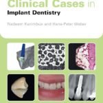 Clinical Cases in Implant Dentistry (Color)