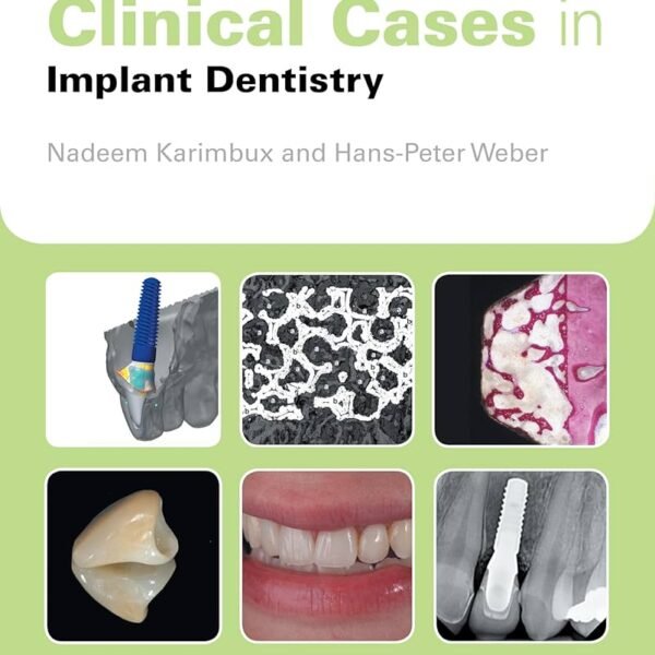 Clinical Cases in Implant Dentistry (Color)