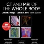 CT and MRI of the Whole Body Volume 1-4 (Color)