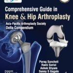 Comprehensive Guide In Knee & Hip Arthroplasty (Color)