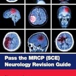 Pass the MRCP (SCE) Neurology Revision Guide (Color)