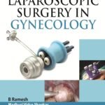 Single-Port Laparoscopic Surgery in Gynecology (Color)