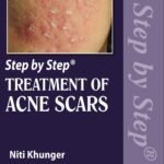 Step by Step Treatment of Acne Scars (Color)