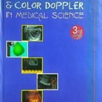 Ultrasound & Color Doppler in Medical Science