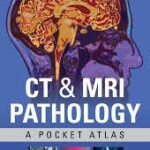 CT & MRI Pathology: A Pocket Atlas (B&W)