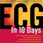 ECG in 10 Days (B&W)