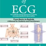 ABC of ECG
