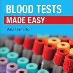 Blood Tests Made Easy,Handbook (Color)