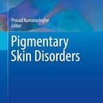 Pigmentary Skin Disorders (Color)