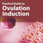 Practical Guide to Ovulation Induction (Color)