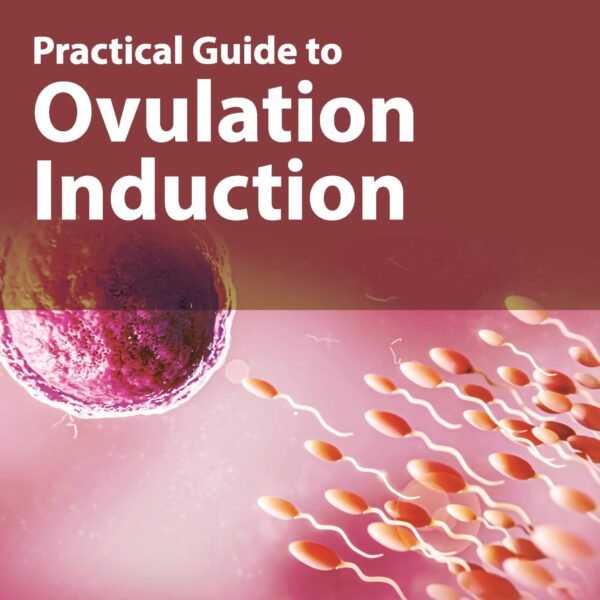 Practical Guide to Ovulation Induction (Color)