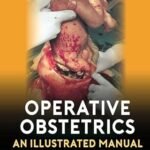 Operative Obstetrics: An Illustrated Manual (Color)