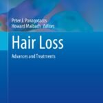 Hair Loss: Advances and Treatments (Color)