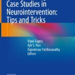 100 Interesting Case Studies in Neurointervention: Tips and Tricks (Color)